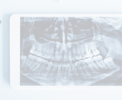 Panoramic digital dental x-rays