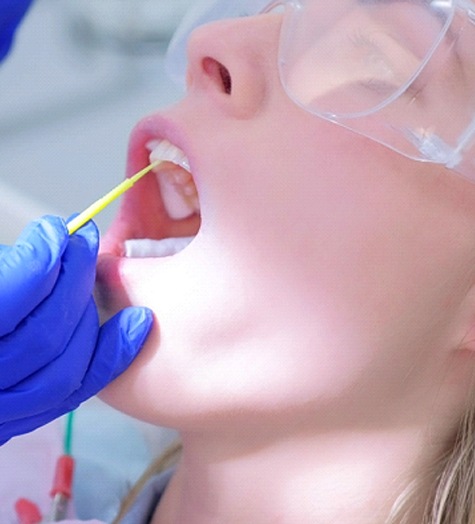 A dentist applies fluoride to the surfaces of a child’s teeth