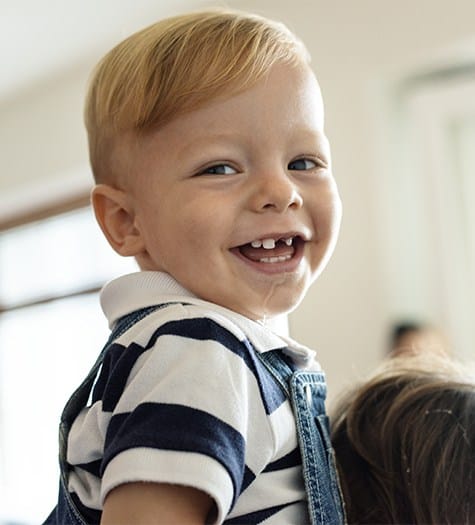 Laughing toddler boy with missing front tooth after space maintainer placement