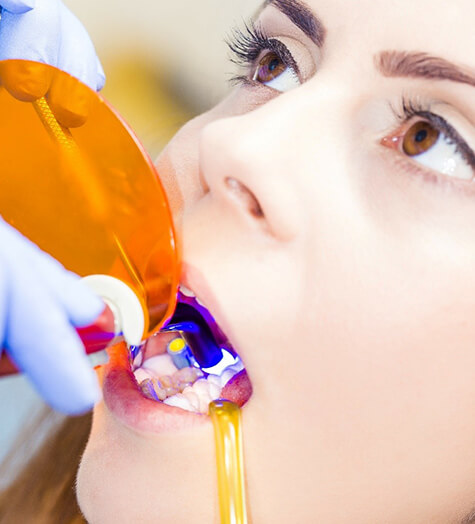 A young female patient having a tooth-colored filling put into place