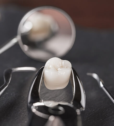 An extracted tooth held between dental instruments