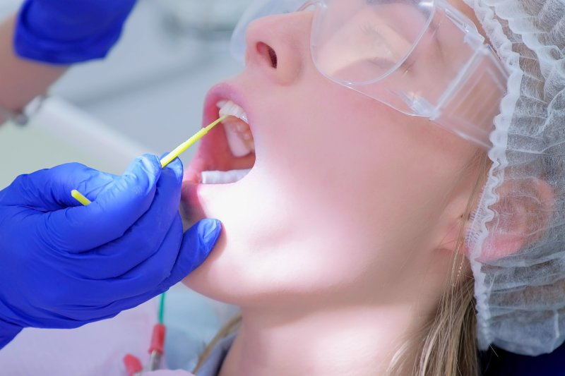 child receiving silver diamine fluoride