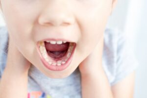 Child with shark teeth
