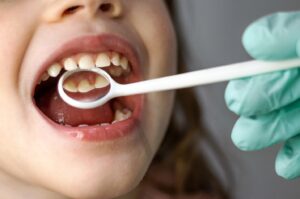 Kid’s mouth being examined by dentist.